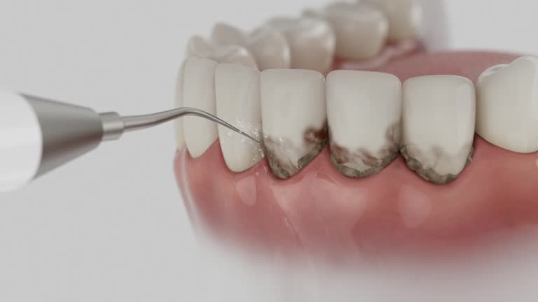 Trusted Wisdom Tooth Removal service in Chilton, WI - Dentist Open Now